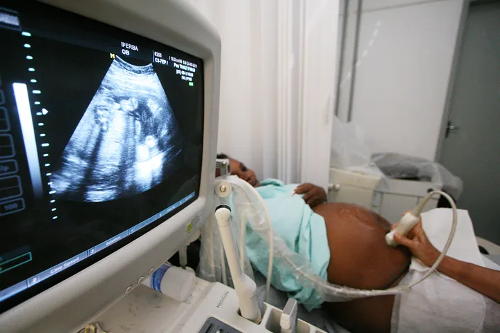 Baixa natalidade é um dos motivos para queda populacional em Salvador 

Na foto: Exame pre-natal feito no IPERBA
Foto: Mateus Pereira / SECOM
Data: 24/05/2011