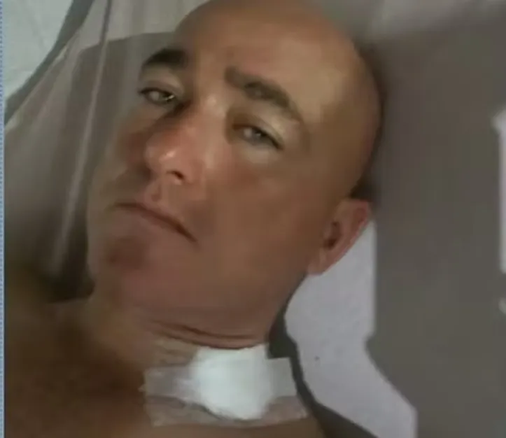 Sargento mostra ferimentos após ser atingido por estilhaços de arma de fogo