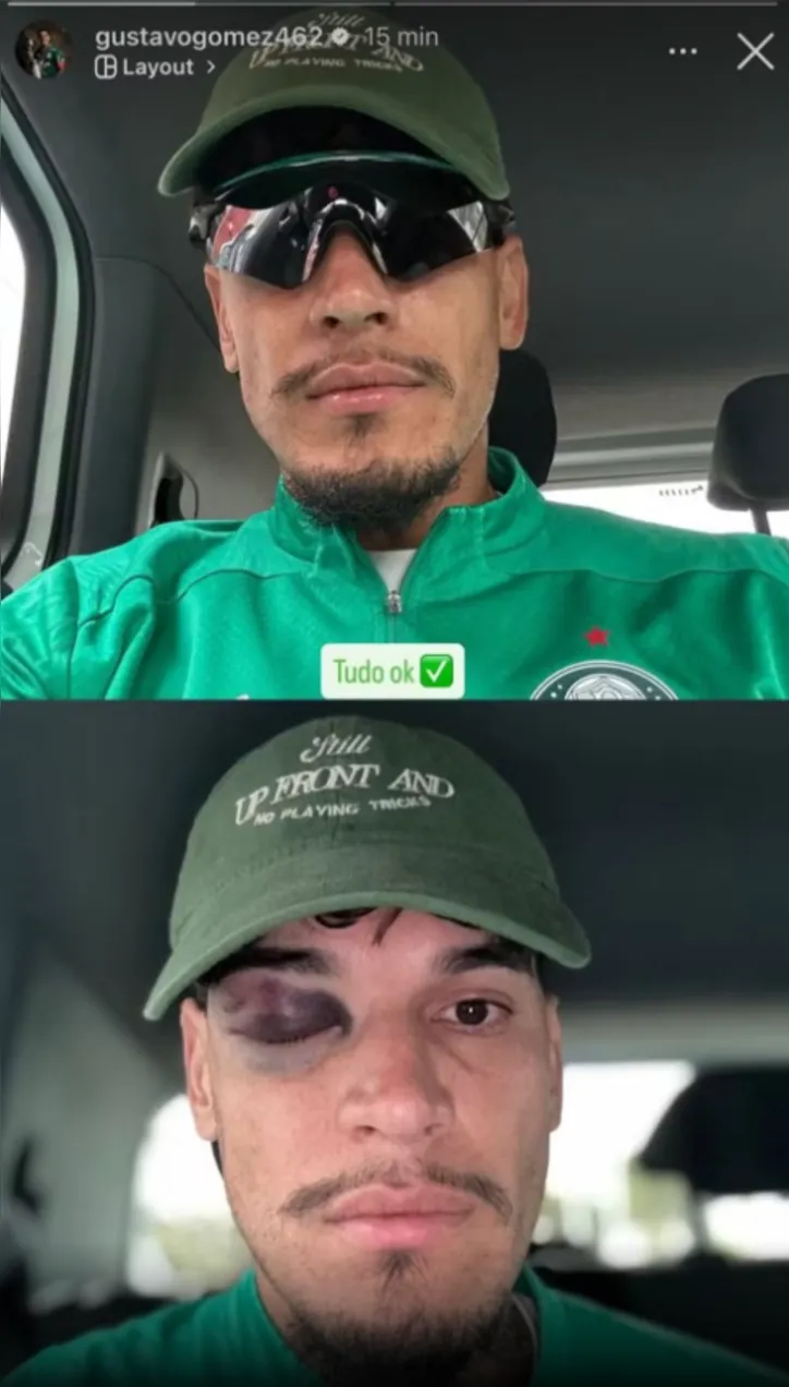 Imagem ilustrativa da imagem Capitão do Palmeiras preocupa e pode não enfrentar o Bahia