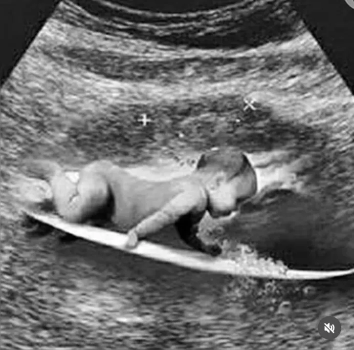 Imagem ilustrativa da imagem Bebê a bordo! Gabriel Medina e Isabella Arantes anunciam gravidez