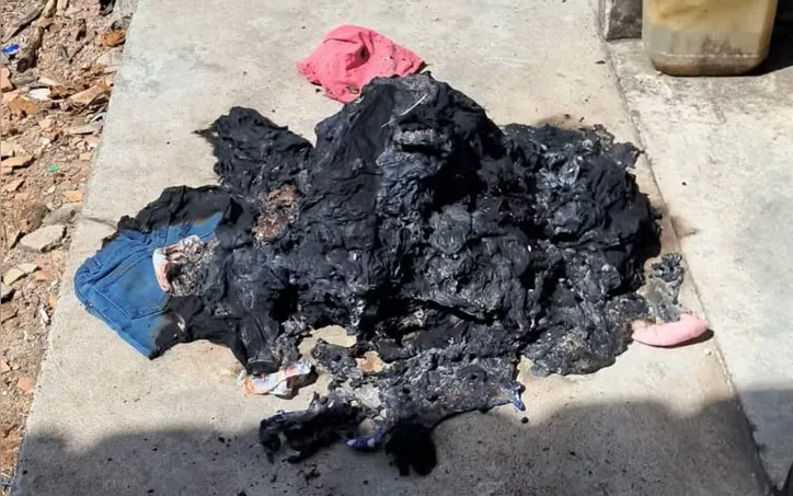 Roupas da criança foram queimadas