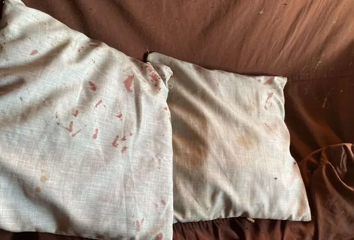 Travesseiros do casal ficaram sujos de sangue