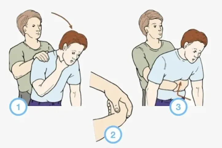 Imagem ilustrativa da imagem Aprenda como agir ao engasgar, com ou sem alguém por perto