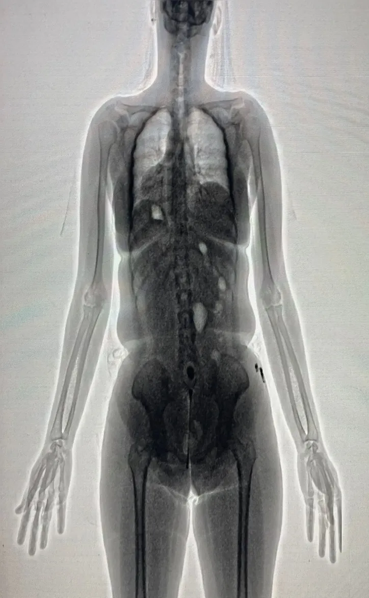 Imagens do equipamento foram arquivadas para medidas administrativas e legais