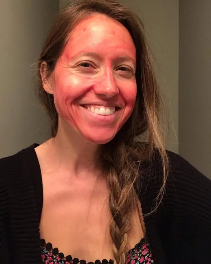 Blogueiras mostram nova tendencia de skin care feita com o próprio sangue menstrual