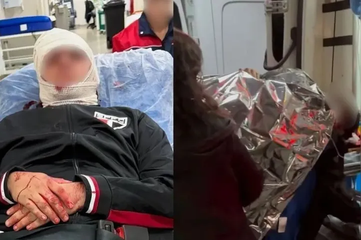 Imagem ilustrativa da imagem São Paulo terá de pagar pensão a torcedor ferido no MorumBIS