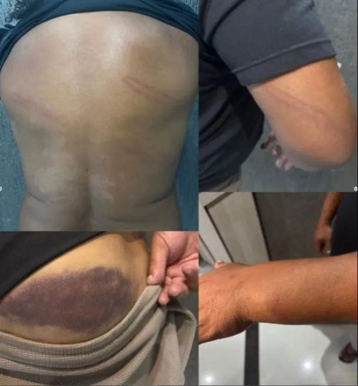 Fotos postadas por Perdigão após agressões sofridas