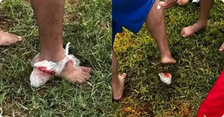 Ataques chamam atenção, mas não são comuns, diz especialista