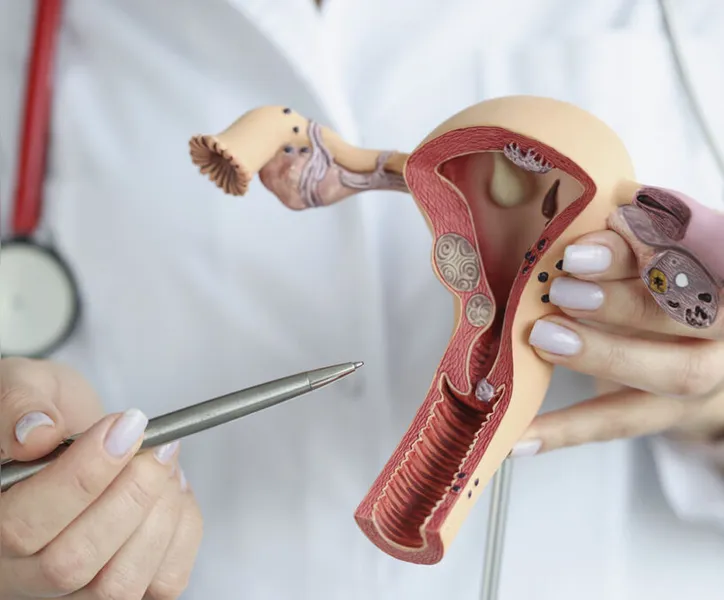 Entre os distúrbios hormonais mais comuns está a síndrome do ovário policístico