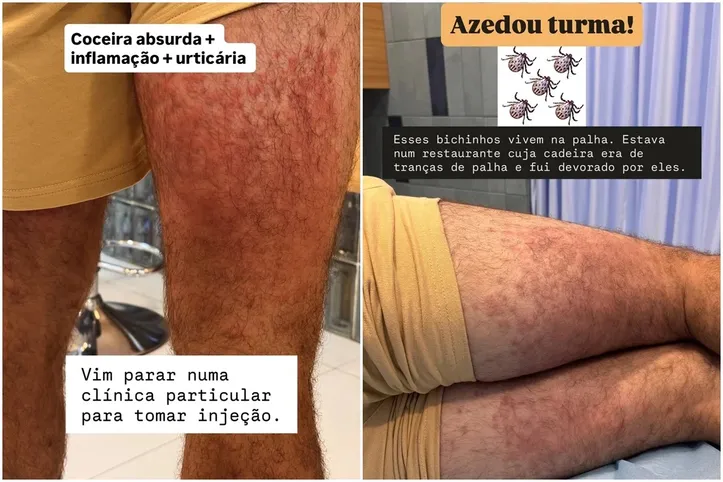 Ator precisou de atendimento médico e descreveu os sintomas