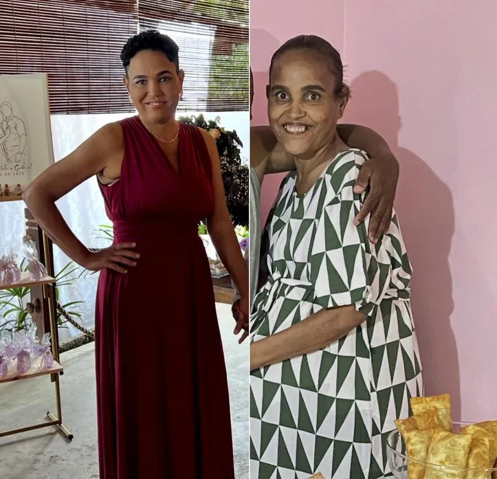 Cristiane Santos Almeida, 47 anos, antes e depois dos transplantes