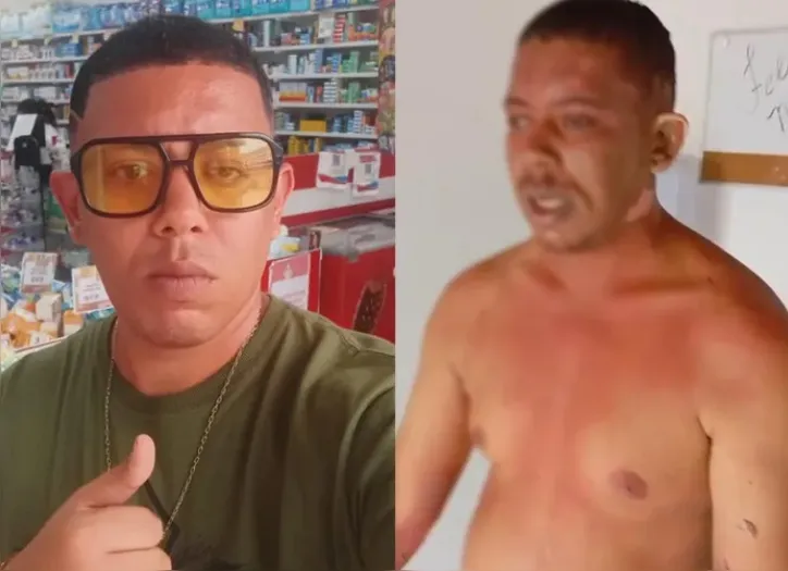 Geovane sofreu várias queimaduras dentro da clínica