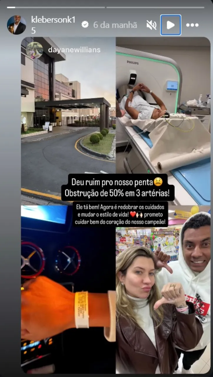 Storie de Kléberson