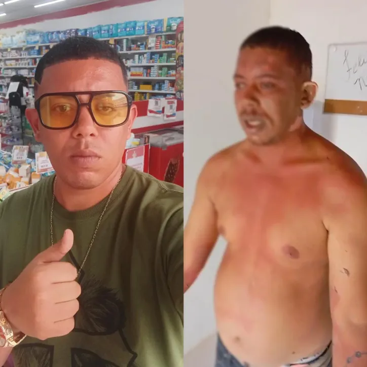 Geovane Santana, interno que apareceu com corpo queimado