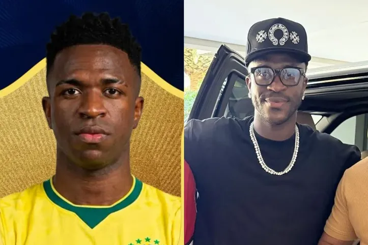 Vinicius Júnior antes e depois de realizar a harmonização de queixo