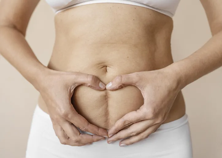 Corpo de uma mulher pós-parto