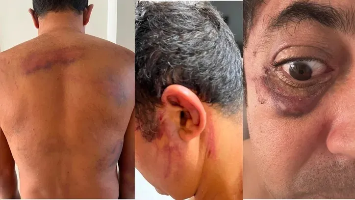 Uma das vítimas de agressão na sede da Bamor