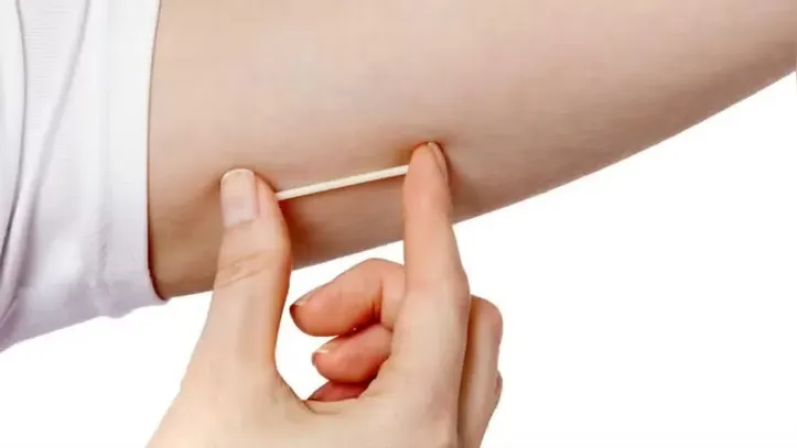 Imagem ilustrativa da imagem Sociedades médicas pedem proibição de implantes hormonais manipulados no Brasil