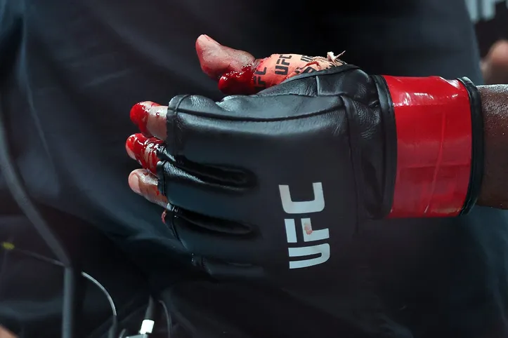 LOS ANGELES, CALIFORNIA - SEPTEMBER 19: A view of the hand of Alonzo Menifield of the United States in his light heavyweight bout against Iwo Baraniewski of Poland during UFC 331: Van v Pantoja 2 at Crypto.com Arena on September 19, 2026 in Los Angeles, California.   Luke Hales/Getty Images/AFP (Photo by Luke Hales / GETTY IMAGES NORTH AMERICA / Getty Images via AFP)