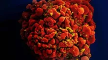 Imagem ilustrativa da imagem Droga contra câncer consegue expulsar HIV de células