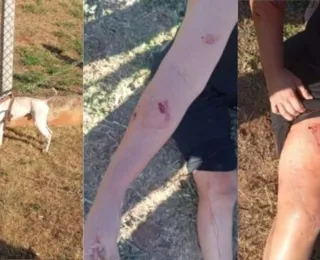 Três pessoas são atacadas por pit-bull durante caminhada